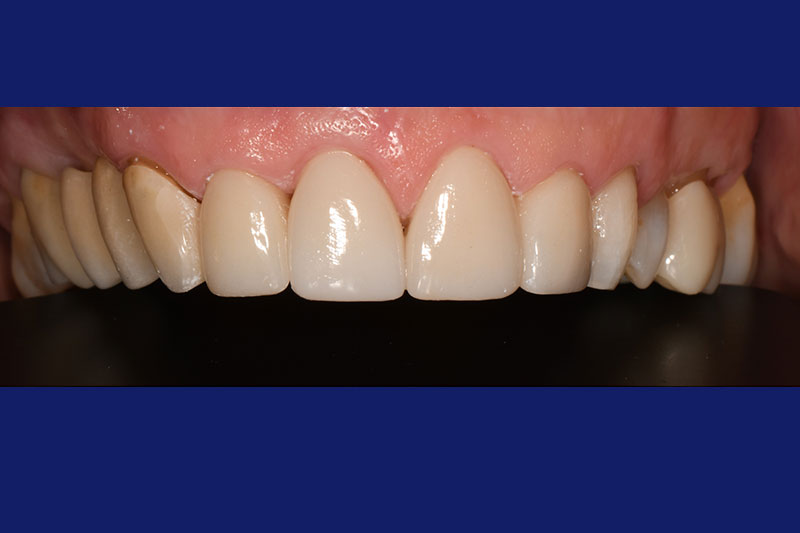 After image