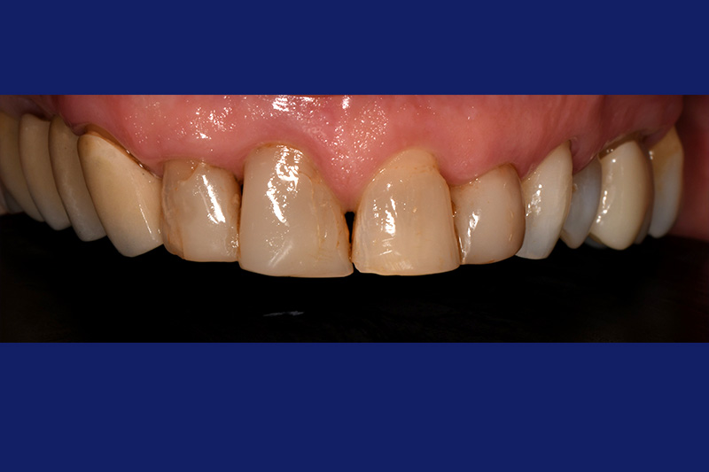 Before image
