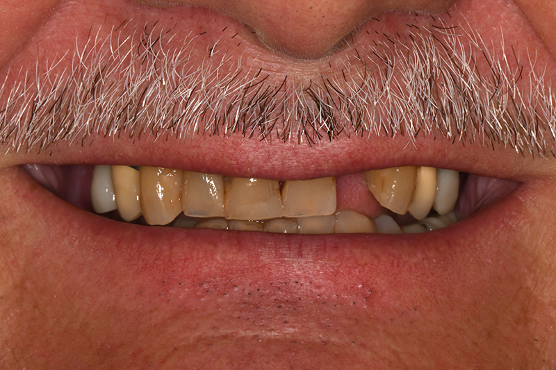 Before image