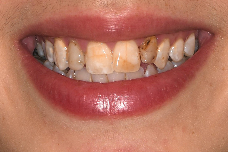Before image