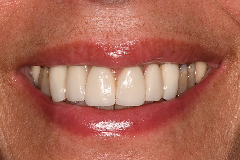After image