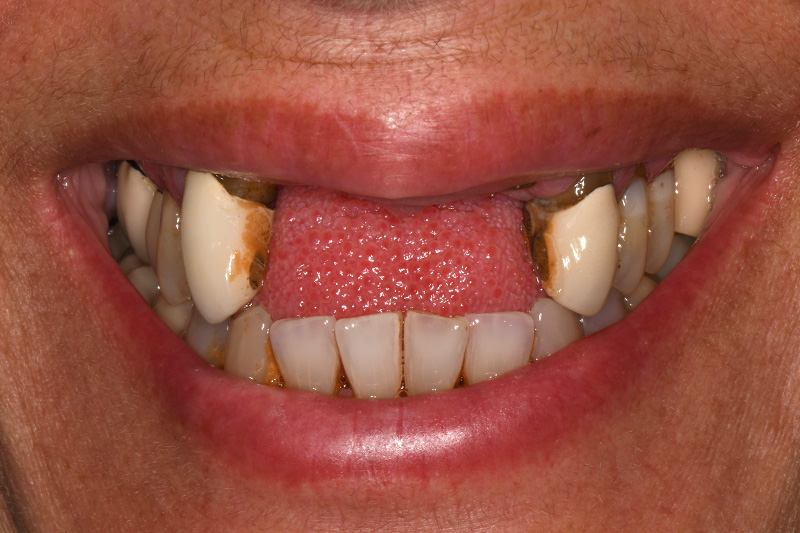 Before image