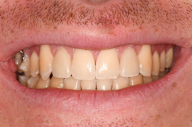 After image