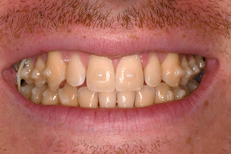 Before image
