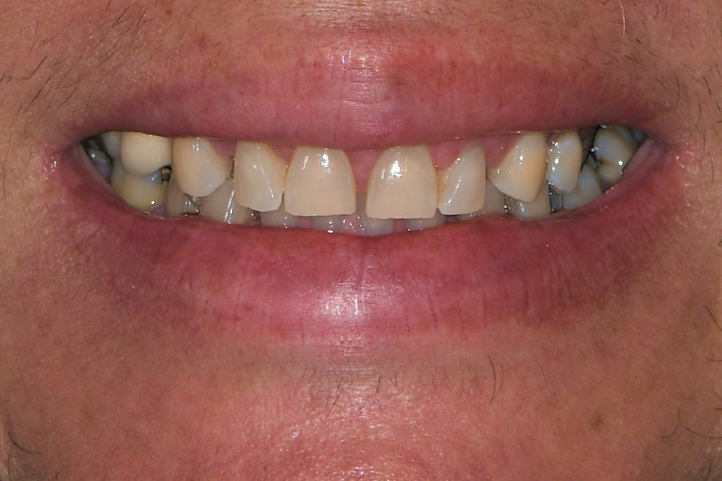 Before image